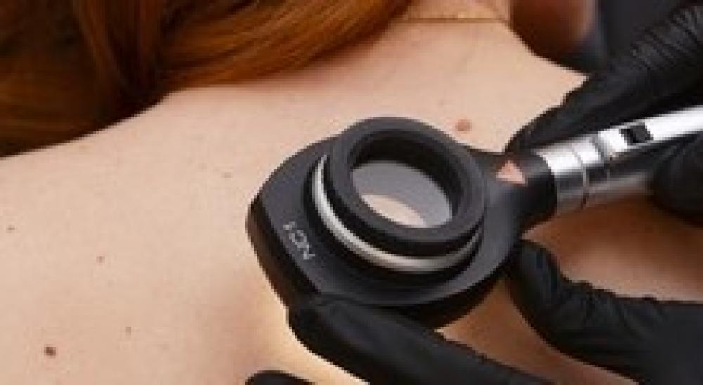 Melanoma e obesità: avanzano due proposte di legge alla Camera