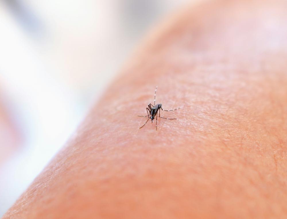 Foto di National Institute of Allergy and Infectious Diseases